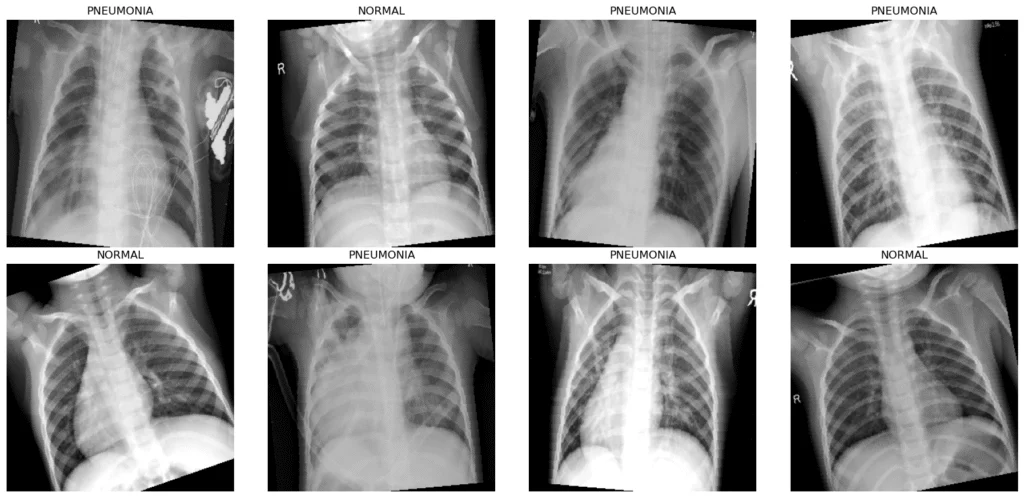 Eight pediatric chest X-rays from one training batch in a four by two grid, each captioned with its class label. Five are labeled pneumonia and three normal. Slight rotations and dark corners show the training augmentations in effect.
