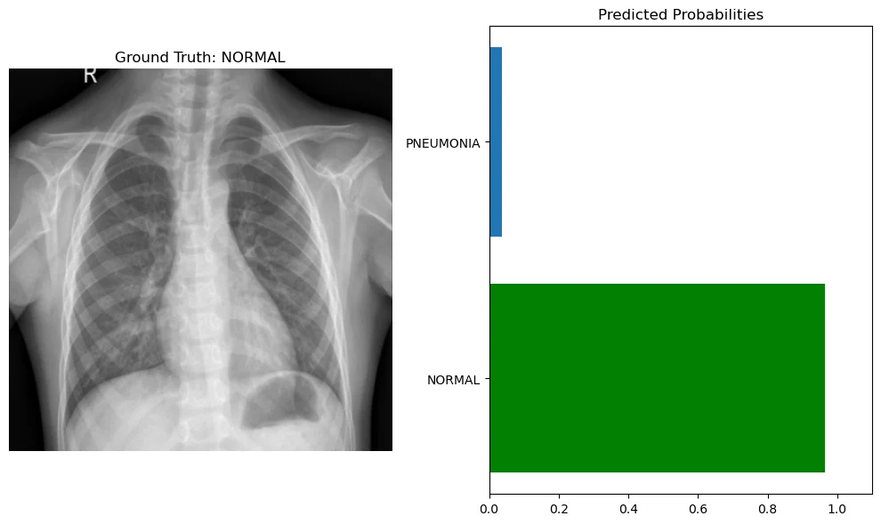 A normal chest X-ray next to a bar chart of predicted probabilities. The model puts about 0.96 on normal, the correct class, and about 0.04 on pneumonia.